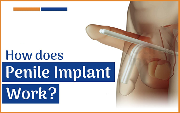 Descriptive text about the image